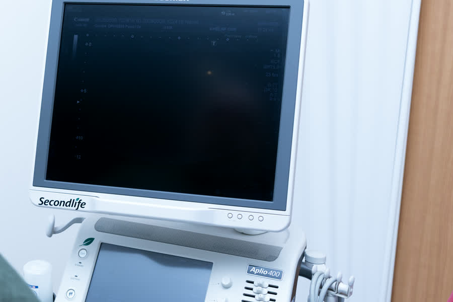 Écran et console de l'échographe Toshiba Aplio 400 dans la salle de gynécologie