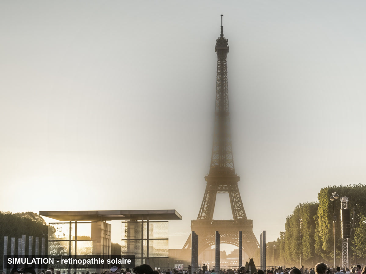 Simulation d'une vision avec un scotome central : la Tour Eiffel apparaît floue au centre du champ visuel, comme en cas de rétinopathie solaire